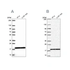 Western blot analysis using Anti-RPS15 antibody HPA057793 (A) shows similar pattern to independent antibody HPA054510 (B).