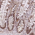 Anti-UBE2M Antibody