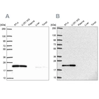 Western blot analysis using Anti-UBE2M antibody HPA057800 (A) shows similar pattern to independent antibody HPA054551 (B).