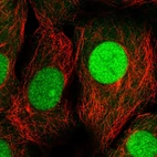 Immunofluorescent staining of human cell line MCF7 shows localization to nucleus & nucleoli.