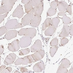 Immunohistochemical staining of human skeletal muscle shows moderate nuclear positivity in myocytes.