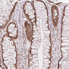 Anti-DEK Antibody