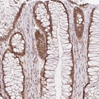 Immunohistochemical staining of human rectum shows strong nuclear positivity in glandular cells.