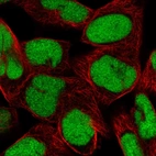 Immunofluorescent staining of human cell line RH-30 shows localization to nucleus.
