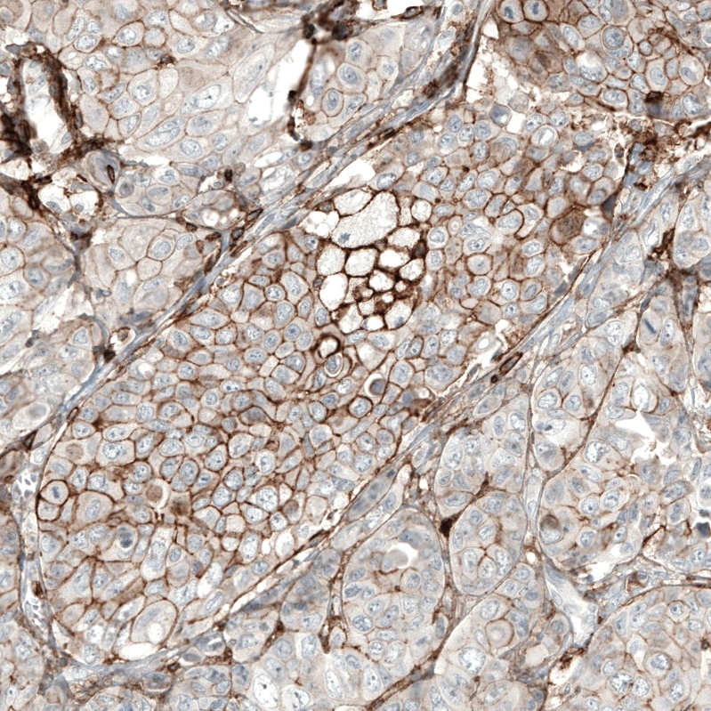 Mouse Monoclonal Anti-CD44 Antibody - Buy for research - Highly ...