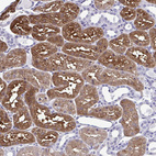 Anti-RASL11B Antibody