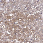 Immunohistochemical staining of human liver shows weak cytoplasmic positivity in hepatocytes.