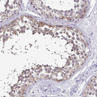 Anti-RASL11B Antibody