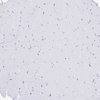 Immunohistochemical staining of human skeletal muscle shows no positivity in myocytes as expected.