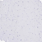 Immunohistochemical staining of human skeletal muscle shows no positivity in myocytes as expected.