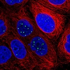 Immunofluorescent staining of human cell line CACO-2 shows localization to nuclear bodies.