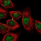 Immunofluorescent staining of human cell line A549 shows localization to nucleoplasm & cytokinetic bridge.