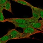 Anti-ST8SIA2 Antibody