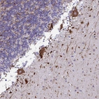 Anti-NAA30 Antibody