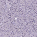 Immunohistochemical staining of human pancreas shows no positivity in exocrine glandular cells as expected.