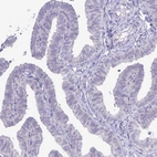 Immunohistochemical staining of human fallopian tube shows no positivity in glandular cells as expected.
