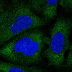Immunofluorescent staining of human cell line U-2 OS shows localization to cytosol.