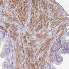 Anti-S100A7L2 Antibody