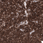 Immunohistochemical staining of human lymph node shows strong membranous positivity in lymphoid cells.