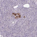 Immunohistochemical staining of human pancreas shows strong cytoplasmic positivity in islets of Langerhans.