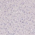 Immunohistochemical staining of human liver shows no positivity in hepatocytes as expected.
