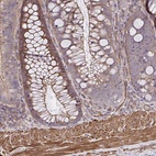 Anti-ZNF696 Antibody