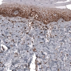 Immunohistochemical staining of human uterine cervix shows moderate membranous positivity in squamous epithelial cells.