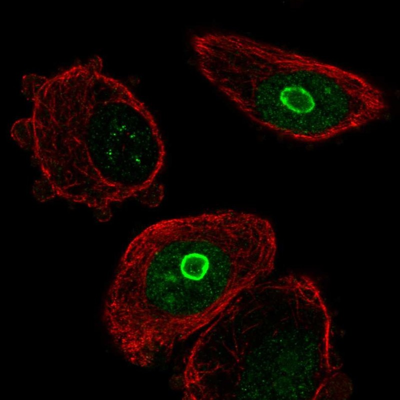 Anti-SLC10A7 Antibody