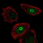 Anti-SLC10A7 Antibody