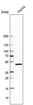 Anti-SLC29A3 Antibody