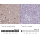Anti-PLCB1 Antibody