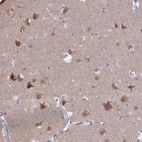Immunohistochemical staining of human cerebral cortex shows high expression.