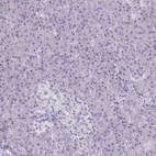 Anti-PLCB1 Antibody