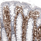 Immunohistochemical staining of human colon shows strong membranous positivity in lymphoid cells.