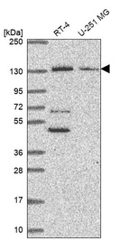 Western blot analysis in human cell line RT-4 and human cell line U-251 MG.