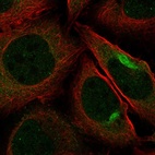 Immunofluorescent staining of human cell line U-2 OS shows localization to nuclear bodies, cytosol & intermediate filaments.