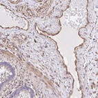 Anti-RNF103 Antibody