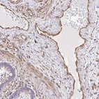 Anti-RNF103 Antibody