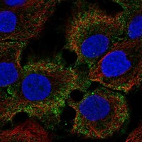 Anti-C1orf68 Antibody