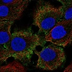 Anti-C1orf68 Antibody