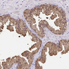 Anti-IDH1 Antibody