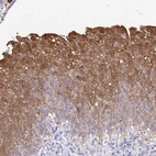 Immunohistochemical staining of human urinary bladder shows moderate cytoplasmic positivity in urothelial cells.