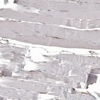 Immunohistochemical staining of human skeletal muscle shows no positivity in myocytes as expected.