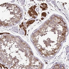 Immunohistochemical staining of human testis shows strong cytoplasmic positivity in Leydig cells.