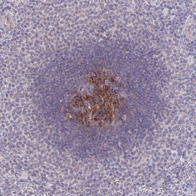 Anti-IL37 Antibody