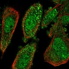 Immunofluorescent staining of human cell line PC-3 shows localization to nucleoplasm & vesicles.