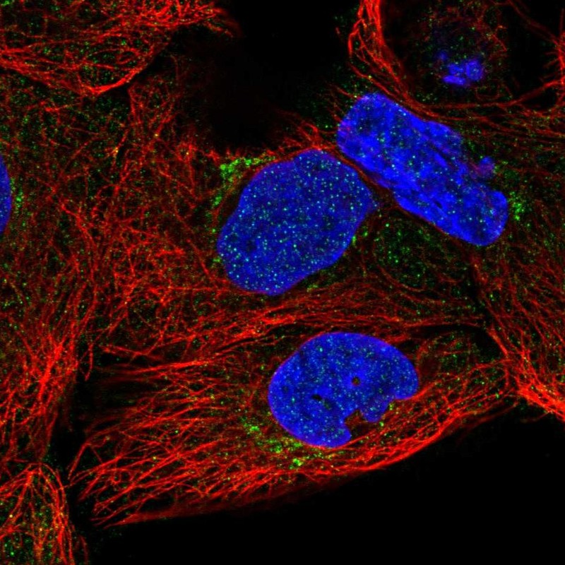 Anti-SLC35A5 Antibody