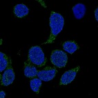 Anti-NCF4 Antibody