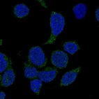 Anti-NCF4 Antibody