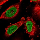 Anti-NSUN3 Antibody